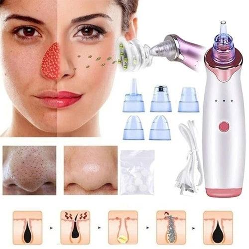 Portable Blackhead Remover™ – Deep Pore Cleansing Device